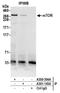 Serine/threonine-protein kinase mTOR antibody, A300-504A, Bethyl Labs, Immunoprecipitation image 