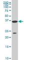 Distal-Less Homeobox 3 antibody, H00001747-M02, Novus Biologicals, Western Blot image 