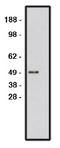 Roundabout Guidance Receptor 1 antibody, AP05287SU-N, Origene, Western Blot image 