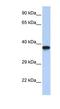 Doublesex- and mab-3-related transcription factor C2 antibody, NBP1-80128, Novus Biologicals, Western Blot image 