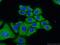Scianna blood group antigen antibody, 21375-1-AP, Proteintech Group, Immunofluorescence image 