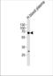 Human Fibrinogen antibody, TA324872, Origene, Western Blot image 