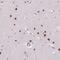 Secondary Ossification Center Associated Regulator Of Chondrocyte Maturation antibody, NBP2-30862, Novus Biologicals, Immunohistochemistry paraffin image 