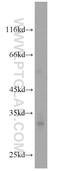 Glycoprotein M6A antibody, 15044-1-AP, Proteintech Group, Western Blot image 