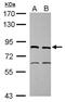ERCC Excision Repair 2, TFIIH Core Complex Helicase Subunit antibody, NBP2-20923, Novus Biologicals, Western Blot image 