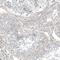 Hornerin antibody, NBP1-80807, Novus Biologicals, Immunohistochemistry paraffin image 