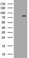 Peptidyl Arginine Deiminase 4 antibody, TA504896BM, Origene, Western Blot image 
