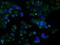 Retinol Dehydrogenase 11 antibody, NBP2-02431, Novus Biologicals, Immunocytochemistry image 