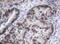 Adrenocortical dysplasia protein homolog antibody, LS-C173789, Lifespan Biosciences, Immunohistochemistry frozen image 