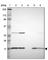 NADH:Ubiquinone Oxidoreductase Subunit B5 antibody, HPA005640, Atlas Antibodies, Western Blot image 