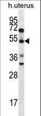 Actin Binding Rho Activating Protein antibody, LS-C155894, Lifespan Biosciences, Western Blot image 