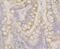 Cytoplasmic Linker Associated Protein 1 antibody, NBP2-76881, Novus Biologicals, Immunohistochemistry paraffin image 
