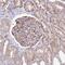 Zinc Finger Protein 14 antibody, NBP2-13552, Novus Biologicals, Immunohistochemistry paraffin image 