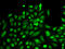 Sphingosine kinase 1 antibody, LS-C746745, Lifespan Biosciences, Immunofluorescence image 