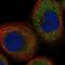 Keratin 20 antibody, NBP1-85598, Novus Biologicals, Immunocytochemistry image 