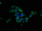 Leucine Rich Repeats And Transmembrane Domains 1 antibody, LS-C398068, Lifespan Biosciences, Immunofluorescence image 