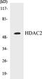 Histone Deacetylase 2 antibody, EKC1262, Boster Biological Technology, Western Blot image 