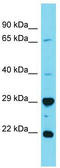 HAUS Augmin Like Complex Subunit 2 antibody, TA337337, Origene, Western Blot image 