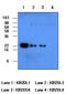 CD158A antibody, LS-C93763, Lifespan Biosciences, Western Blot image 