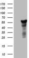 Leucine Rich Repeat Containing 6 antibody, TA805970S, Origene, Western Blot image 