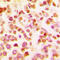 BCL6 Transcription Repressor antibody, LS-C354294, Lifespan Biosciences, Immunohistochemistry frozen image 