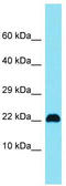 Uncharacterized protein C15orf32 antibody, TA333470, Origene, Western Blot image 