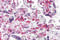 RUN And SH3 Domain Containing 2 antibody, 5413, ProSci, Immunohistochemistry paraffin image 