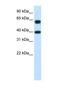 Nuclear RNA Export Factor 3 antibody, NBP1-57276, Novus Biologicals, Western Blot image 