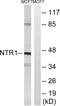 Neurotensin Receptor 1 antibody, A30849, Boster Biological Technology, Western Blot image 