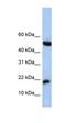 LOC285033 antibody, orb325925, Biorbyt, Western Blot image 
