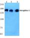 Atrophin-1 antibody, A03828-2, Boster Biological Technology, Western Blot image 