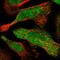 CutC Copper Transporter antibody, HPA038619, Atlas Antibodies, Immunocytochemistry image 