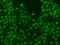 Methyltransferase Like 14 antibody, 204202-T02, Sino Biological, Immunohistochemistry paraffin image 