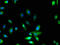Myosin-X antibody, A62998-100, Epigentek, Immunofluorescence image 