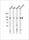 Leukocyte immunoglobulin-like receptor subfamily B member 1 antibody, 58-904, ProSci, Western Blot image 