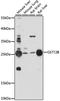 Glutathione S-Transferase Theta 2B (Gene/Pseudogene) antibody, A11667, Boster Biological Technology, Western Blot image 