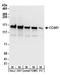 Cell Division Cycle And Apoptosis Regulator 1 antibody, A300-435A, Bethyl Labs, Western Blot image 