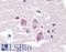 Adhesion G Protein-Coupled Receptor V1 antibody, LS-A1725, Lifespan Biosciences, Immunohistochemistry paraffin image 