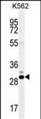 Cancer/Testis Antigen Family 45 Member A1 antibody, PA5-48156, Invitrogen Antibodies, Western Blot image 