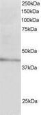Low Density Lipoprotein Receptor Adaptor Protein 1 antibody, PA1-31943, Invitrogen Antibodies, Western Blot image 
