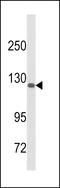 Desmocollin 1 antibody, LS-C167539, Lifespan Biosciences, Western Blot image 