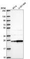 1-Acylglycerol-3-Phosphate O-Acyltransferase 1 antibody, PA5-67286, Invitrogen Antibodies, Western Blot image 