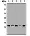 Hippocalcin Like 1 antibody, orb411639, Biorbyt, Western Blot image 