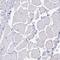 Cell Division Cycle 20 antibody, NBP2-38750, Novus Biologicals, Immunohistochemistry paraffin image 
