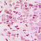AT-Rich Interaction Domain 1B antibody, GTX56037, GeneTex, Immunohistochemistry paraffin image 