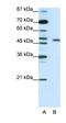 Potassium Voltage-Gated Channel Subfamily A Regulatory Beta Subunit 2 antibody, orb324737, Biorbyt, Western Blot image 