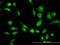 Carboxypeptidase Vitellogenic Like antibody, H00054504-M01, Novus Biologicals, Immunofluorescence image 