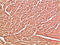 Cadherin-5 antibody, M02632-3, Boster Biological Technology, Immunohistochemistry paraffin image 