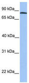 Disintegrin and metalloproteinase domain-containing protein 7 antibody, TA335762, Origene, Western Blot image 
