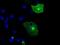 Neurotrophic Receptor Tyrosine Kinase 3 antibody, NBP1-47900, Novus Biologicals, Immunocytochemistry image 